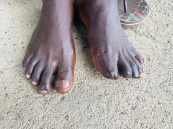 Koidu Holdings Layoffs Spark Labour Crisis in Sierra Leone&rsquo;s Kono District