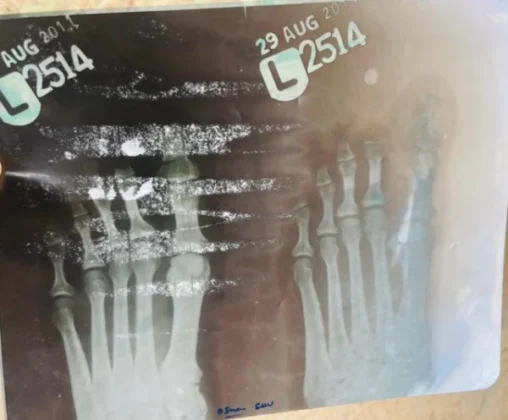 Koidu Holdings Layoffs Spark Labour Crisis in Sierra Leone&rsquo;s Kono District